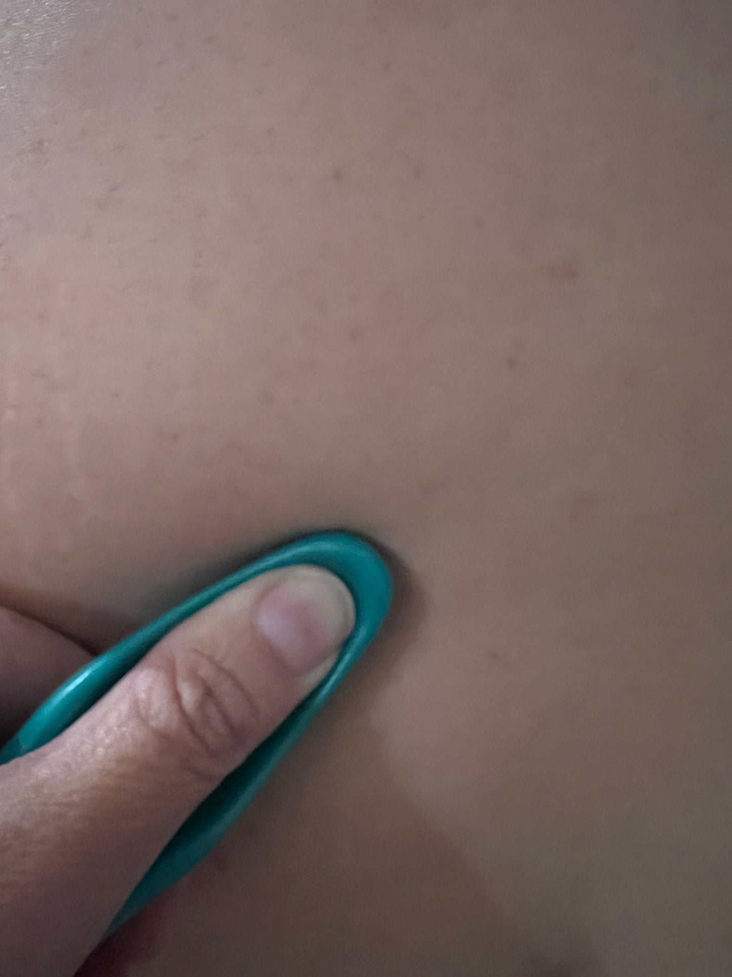 XL LUPIN HEAT PACK / MASSAGE SET